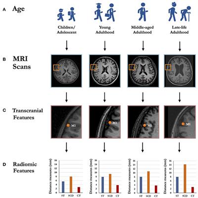 Radiomics-Informed Modeling for Transcranial Ultrasound Stimulation: Age Matters